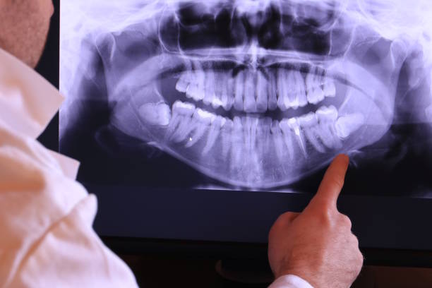 Best Weekend Emergency Dentist in Valley City, ND