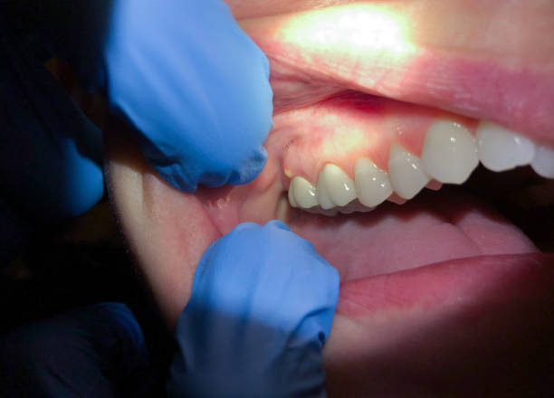 Fast & Reliable Emergency Dental Services in ND